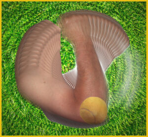 Tennis Elbow