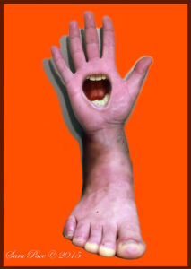 Hand, Foot and Mouth